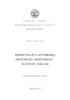 prikaz prve stranice dokumenta Dermatoglifi u autoimunoj hipotireozi i hipertireozi – sličnosti i razlike